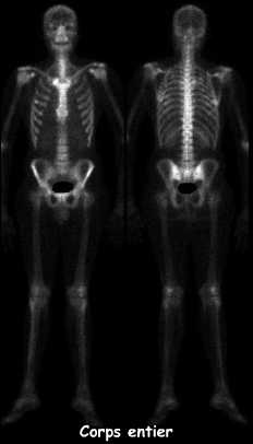 Corps entier